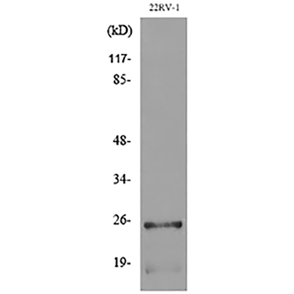 SSX兔多抗,SSX Rabbit Polyclonal Antibody