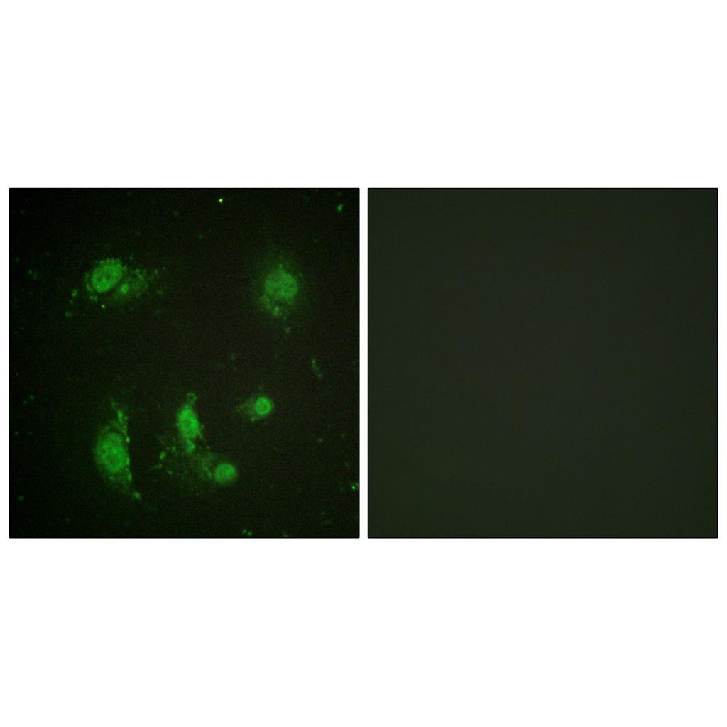 Survivin兔多抗,Survivin Rabbit Polyclonal Antibody