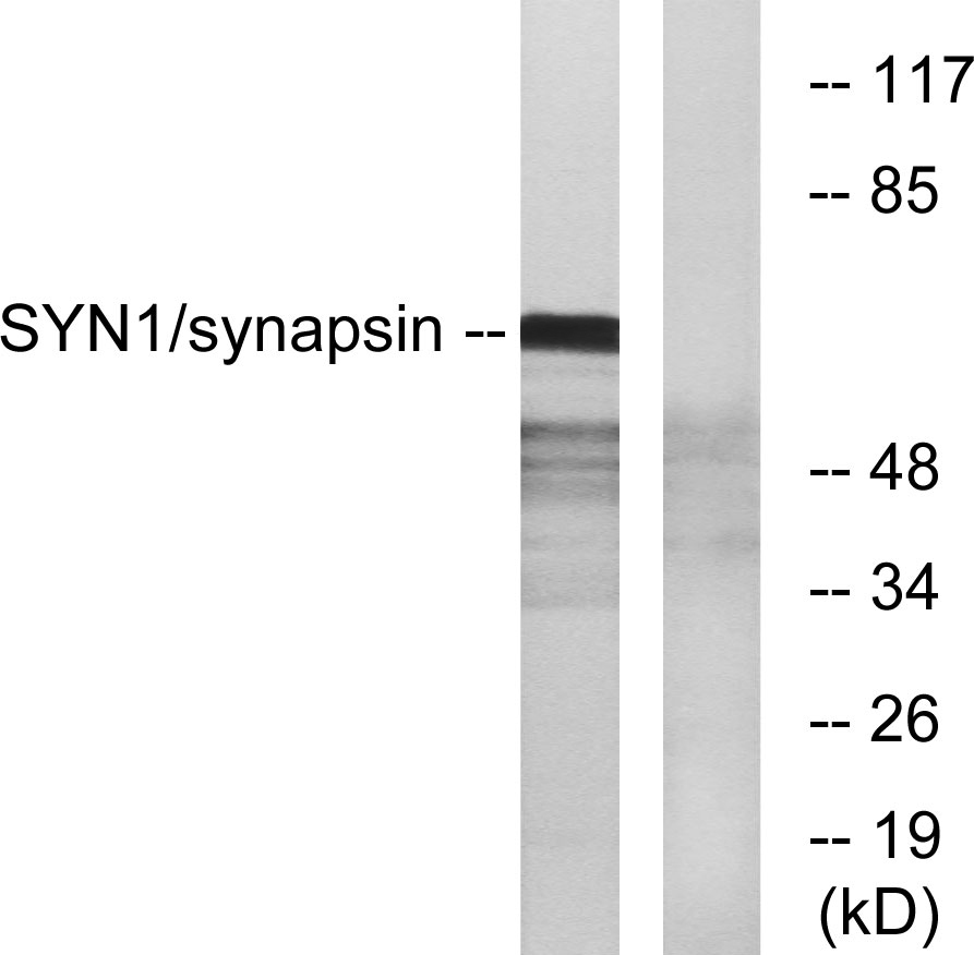 Synapsin I兔多抗,Synapsin I Rabbit Polyclonal Antibody
