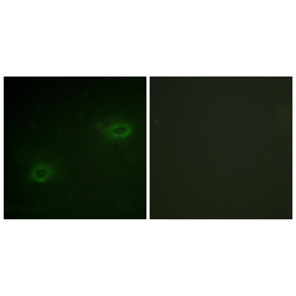 Syndecan-4兔多抗,Syndecan-4 Rabbit Polyclonal Antibody