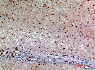 Synuclein-α兔多抗,Synuclein-α Rabbit Polyclonal Antibody