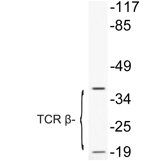 TCR β兔多抗,TCR β Rabbit Polyclonal Antibody
