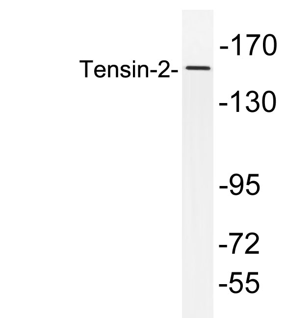 Tensin-2兔多抗,Tensin-2 Rabbit Polyclonal Antibody