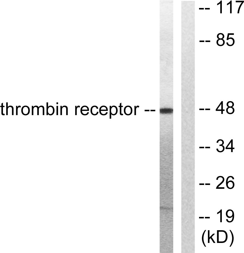 Thrombin R兔多抗,Thrombin R Rabbit Polyclonal Antibody
