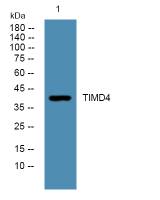 TIMD4兔多抗,TIMD4 Rabbit Polyclonal Antibody