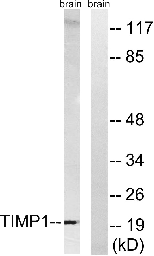 TIMP-1兔多抗,TIMP-1 Rabbit Polyclonal Antibody