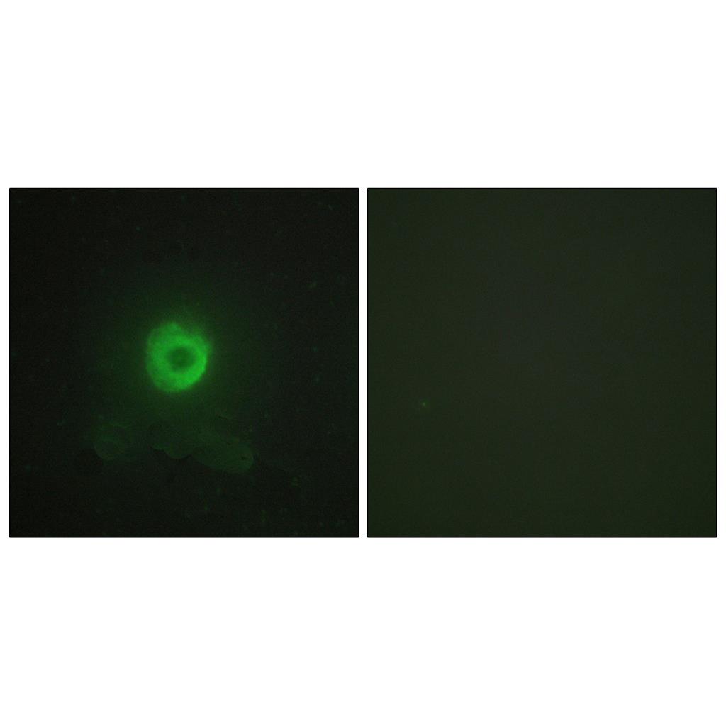 TNF-R2兔多抗,TNF-R2 Rabbit Polyclonal Antibody