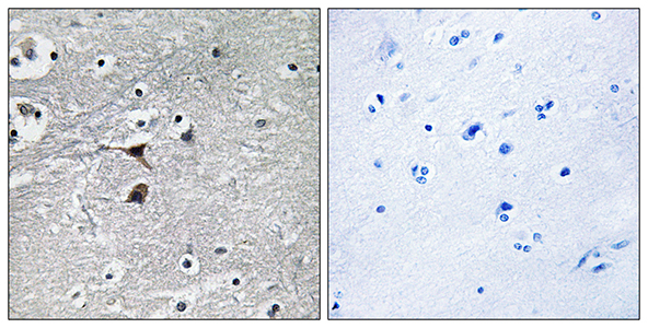 TPH1兔多抗,TPH1 Rabbit Polyclonal Antibody
