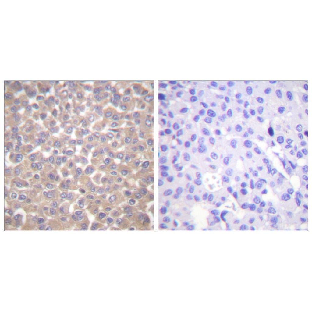 TRADD兔多抗,TRADD Rabbit Polyclonal Antibody
