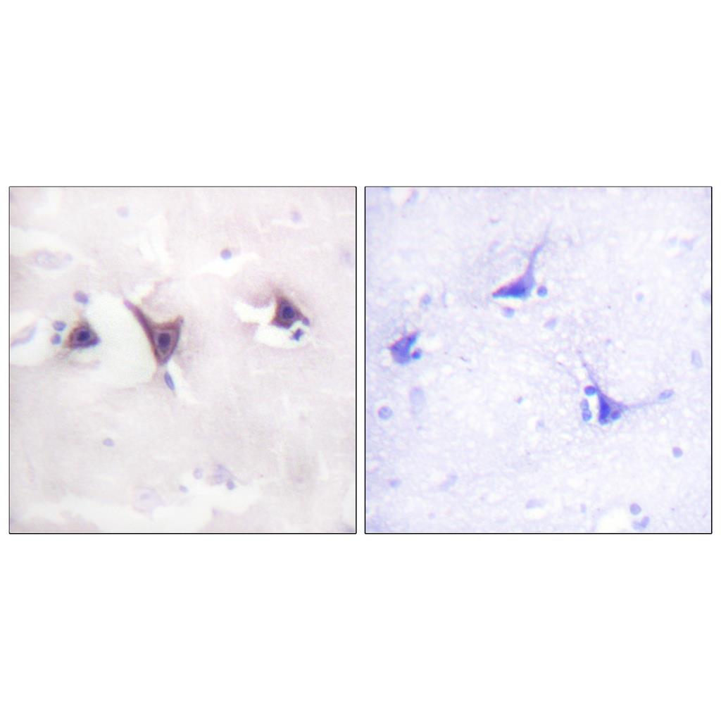 Trk B兔多抗,Trk B Rabbit Polyclonal Antibody