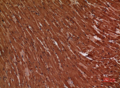 Troponin T-C兔多抗,Troponin T-C Rabbit Polyclonal Antibody