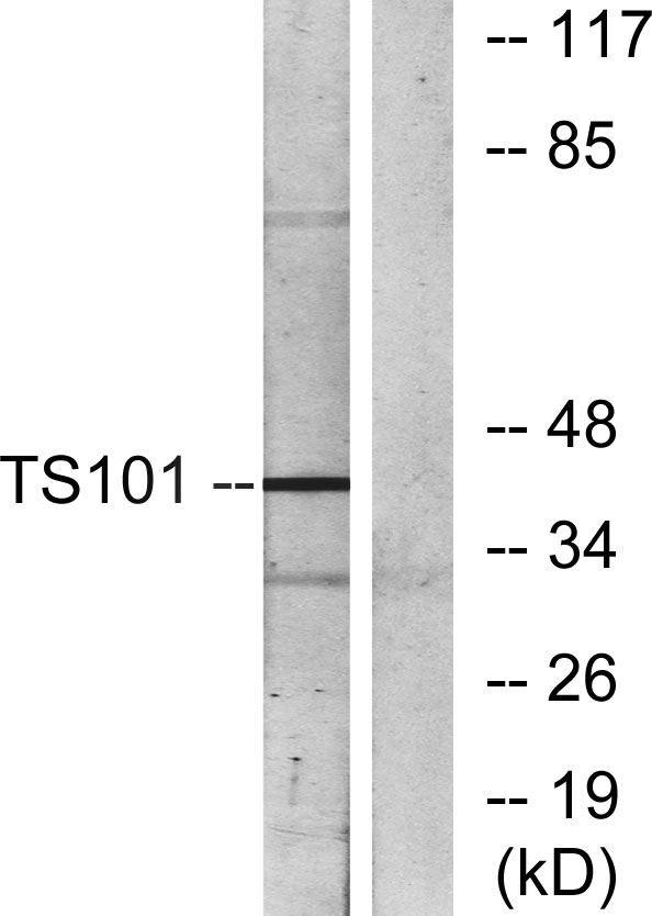 Tsg 101兔多抗,Tsg 101 Rabbit Polyclonal Antibody