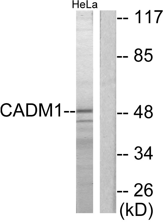 TSLC1兔多抗,TSLC1 Rabbit Polyclonal Antibody