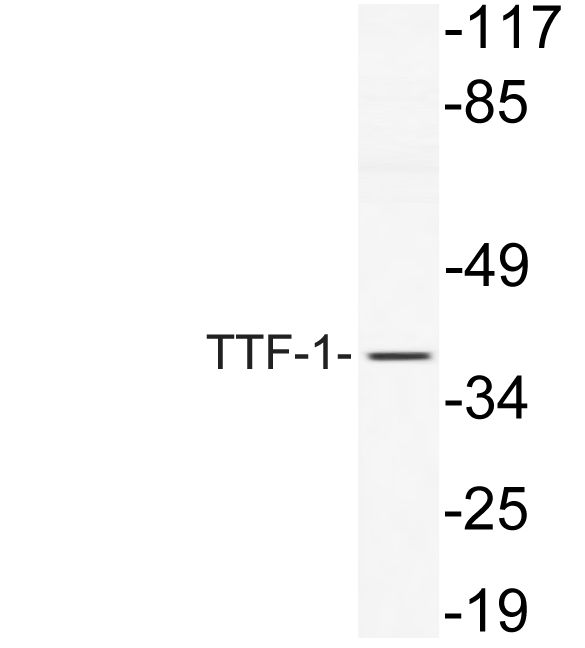 TTF-1兔多抗,TTF-1 Rabbit Polyclonal Antibody