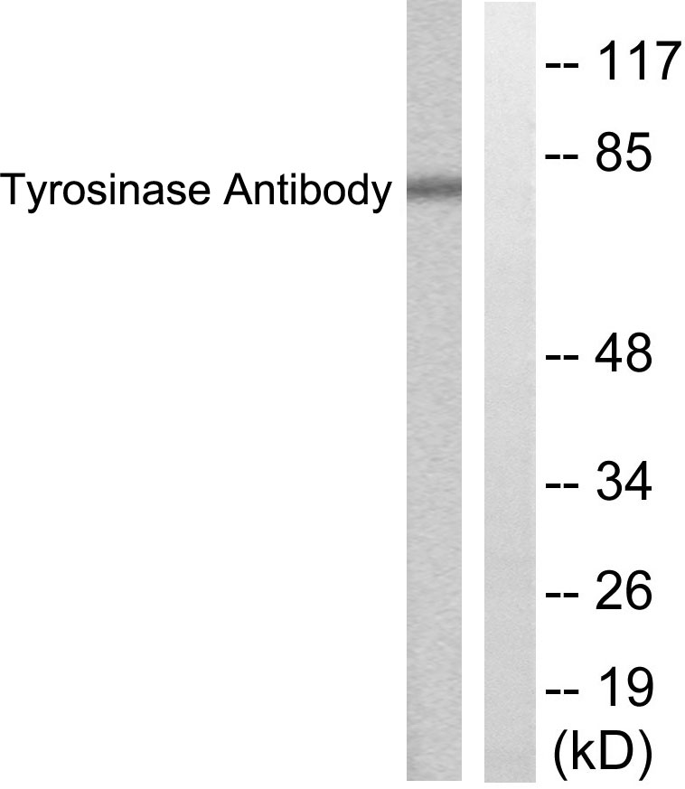 TYR兔多抗,TYR Rabbit Polyclonal Antibody