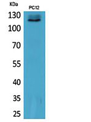 UBA1兔多抗,UBA1 Rabbit Polyclonal Antibody