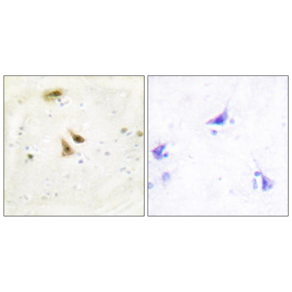 UBF-1兔多抗,UBF-1 Rabbit Polyclonal Antibody