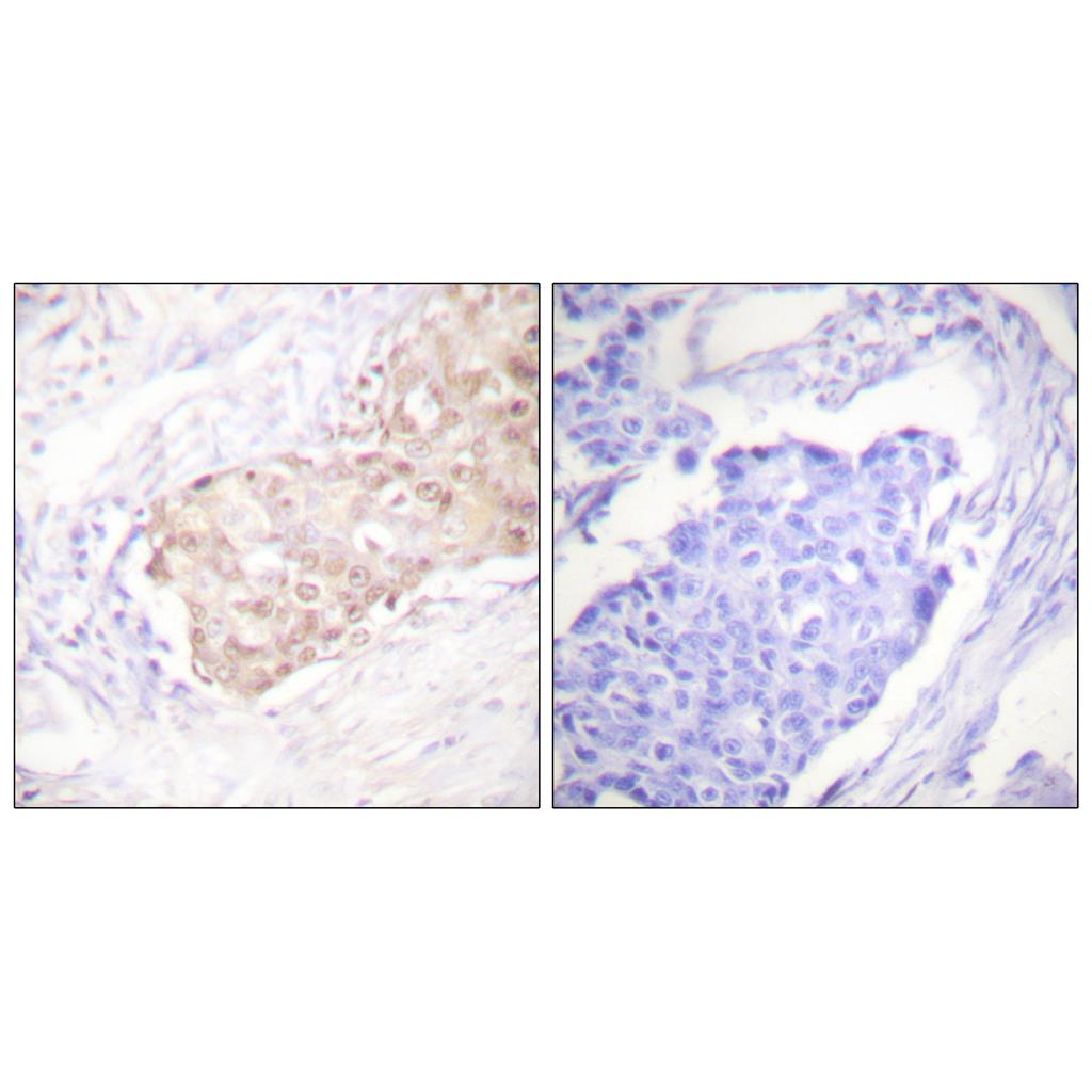 UBR5兔多抗,UBR5 Rabbit Polyclonal Antibody