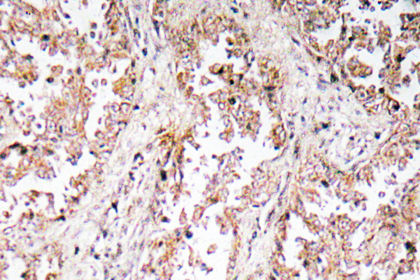 UCP2兔多抗,UCP2 Rabbit Polyclonal Antibody