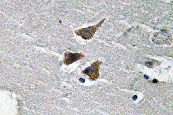 uPA兔多抗,uPA Rabbit Polyclonal Antibody