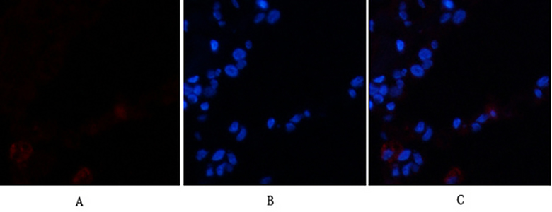VE-Cadherin兔多抗,VE-Cadherin Rabbit Polyclonal Antibody