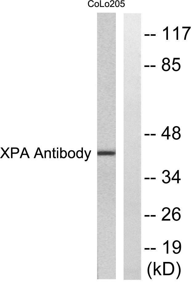 XPA兔多抗,XPA Rabbit Polyclonal Antibody