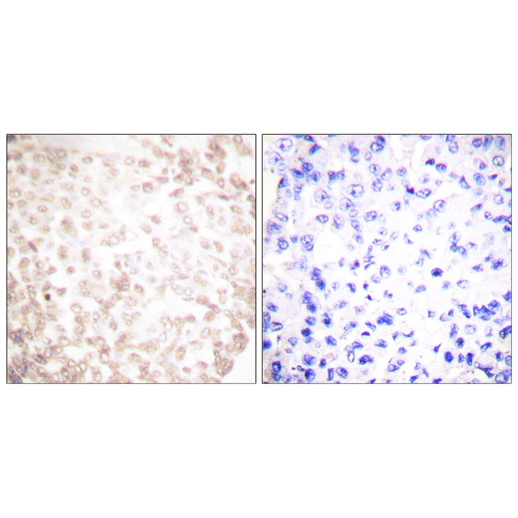 XRCC1兔多抗,XRCC1 Rabbit Polyclonal Antibody