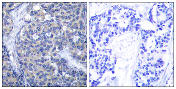ZAP-70兔多抗,ZAP-70 Rabbit Polyclonal Antibody