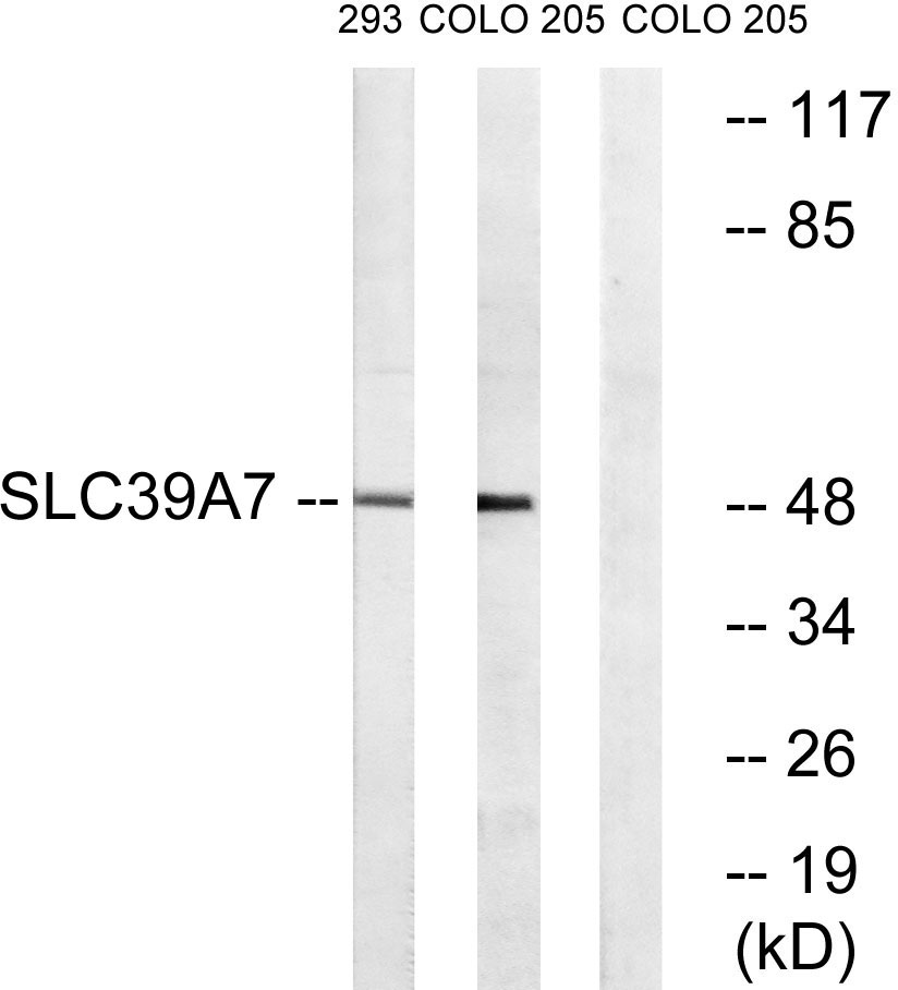ZIP7兔多抗,ZIP7 Rabbit Polyclonal Antibody