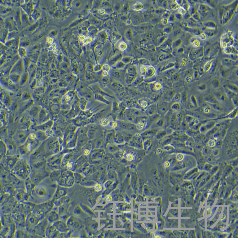 EFO-27（人卵巢腺癌细胞）YB-72052HC,EFO-27