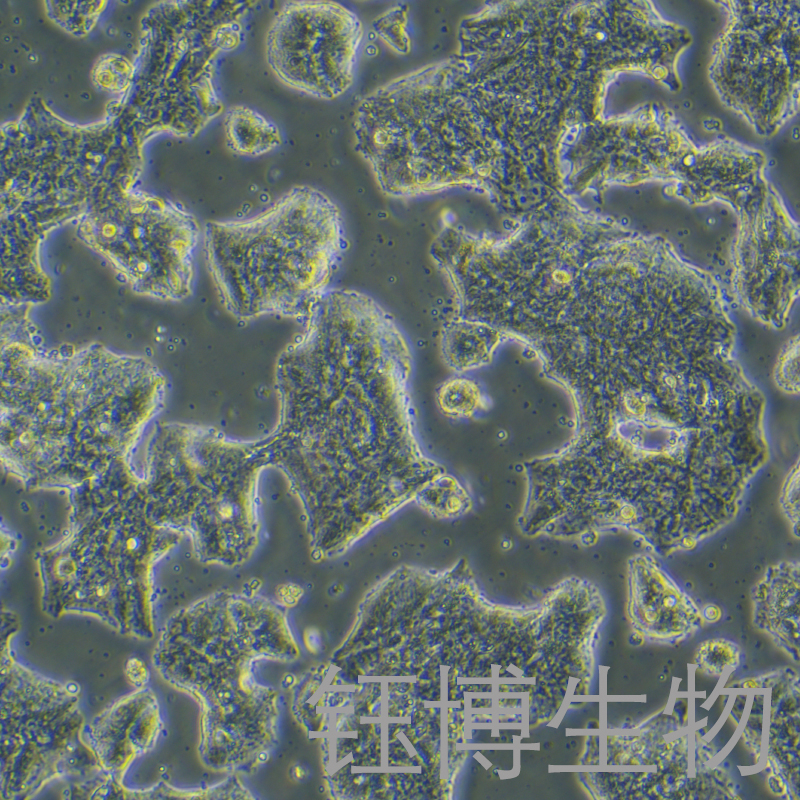 SW1463（人直肠腺癌细胞）YB-72055HC,SW1463