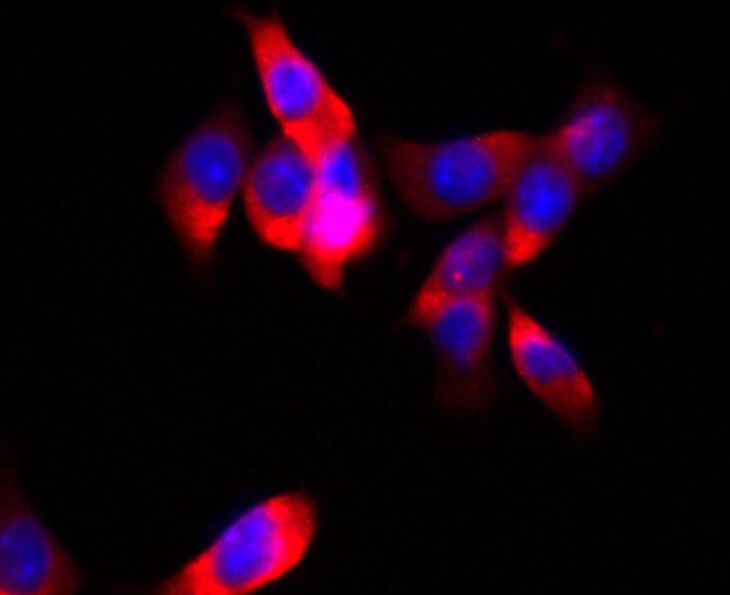 人膀胱癌细胞5637,Human bladder cancer cells