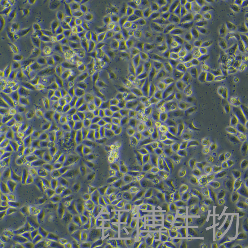 VK2/E6E7（人子宫内膜异位症阴道粘膜上皮细胞）YB-72059HC,VK2/E6E7