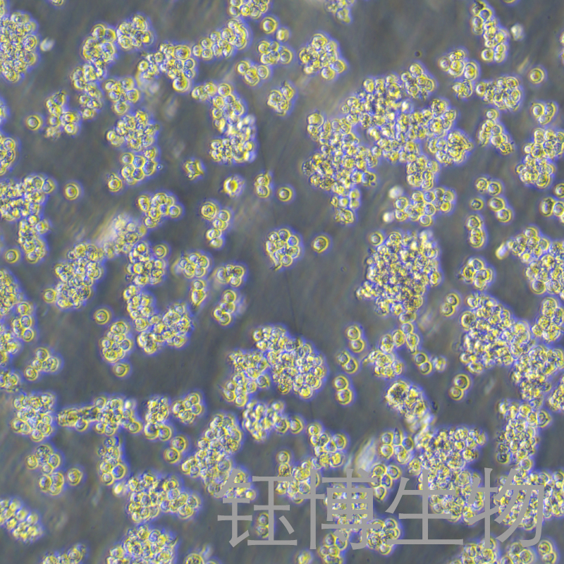TMD8（人弥漫性大B细胞淋巴瘤）YB-72069HC,TMD8
