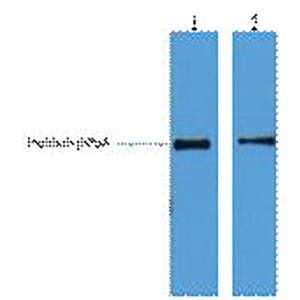 His-Tag单抗(4E6),His-Tag Monoclonal Antibody(4E6)