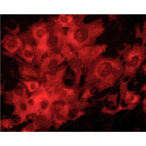 大鼠小梁网细胞,Rat trabecular meshwork cells
