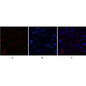 DDIT3 (7G7)鼠单抗,DDIT3 (7G7) Mouse Monoclonal Antibody