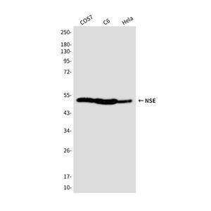 NSE (4C7)鼠单抗,NSE (4C7) Mouse Monoclonal Antibody