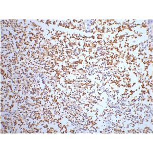 NSE (4C7)鼠单抗,NSE (4C7) Mouse Monoclonal Antibody