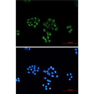 NSE (4C7)鼠单抗,NSE (4C7) Mouse Monoclonal Antibody