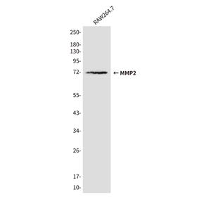 MMP2 (3A8)鼠单抗,MMP2 (3A8) Mouse Monoclonal Antibody
