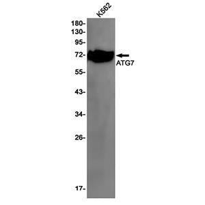 ATG7兔单抗,ATG7 Rabbit Monoclonal Antibody