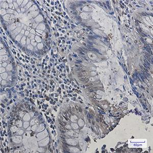 HP1 alpha兔单抗,HP1 alpha Rabbit Monoclonal Antibody