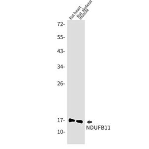 NDUFB11兔单抗,NDUFB11 Rabbit Monoclonal Antibody