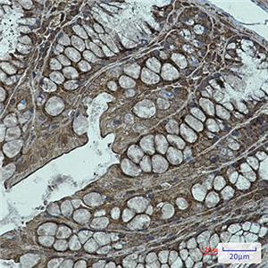 NDUFB11兔单抗,NDUFB11 Rabbit Monoclonal Antibody