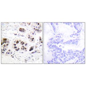 Acetyl Histone H2A (K5)兔多抗,Acetyl Histone H2A (K5) Rabbit Polyclonal Antibody