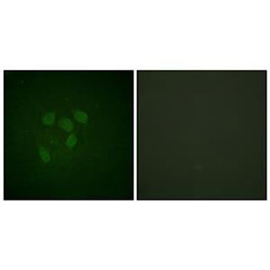 Acetyl p53 (K319)兔多抗,Acetyl p53 (K319) Rabbit Polyclonal Antibody