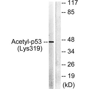 Acetyl p53 (K319)兔多抗,Acetyl p53 (K319) Rabbit Polyclonal Antibody