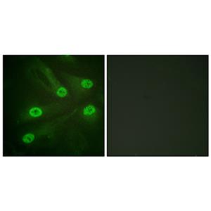 Acetyl p53 (K386)兔多抗,Acetyl p53 (K386) Rabbit Polyclonal Antibody
