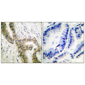 Acetyl p53 (K386)兔多抗,Acetyl p53 (K386) Rabbit Polyclonal Antibody